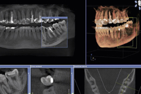 小絹駅・絹の台歯科クリニック・歯科用CTによる精密検査を徹底